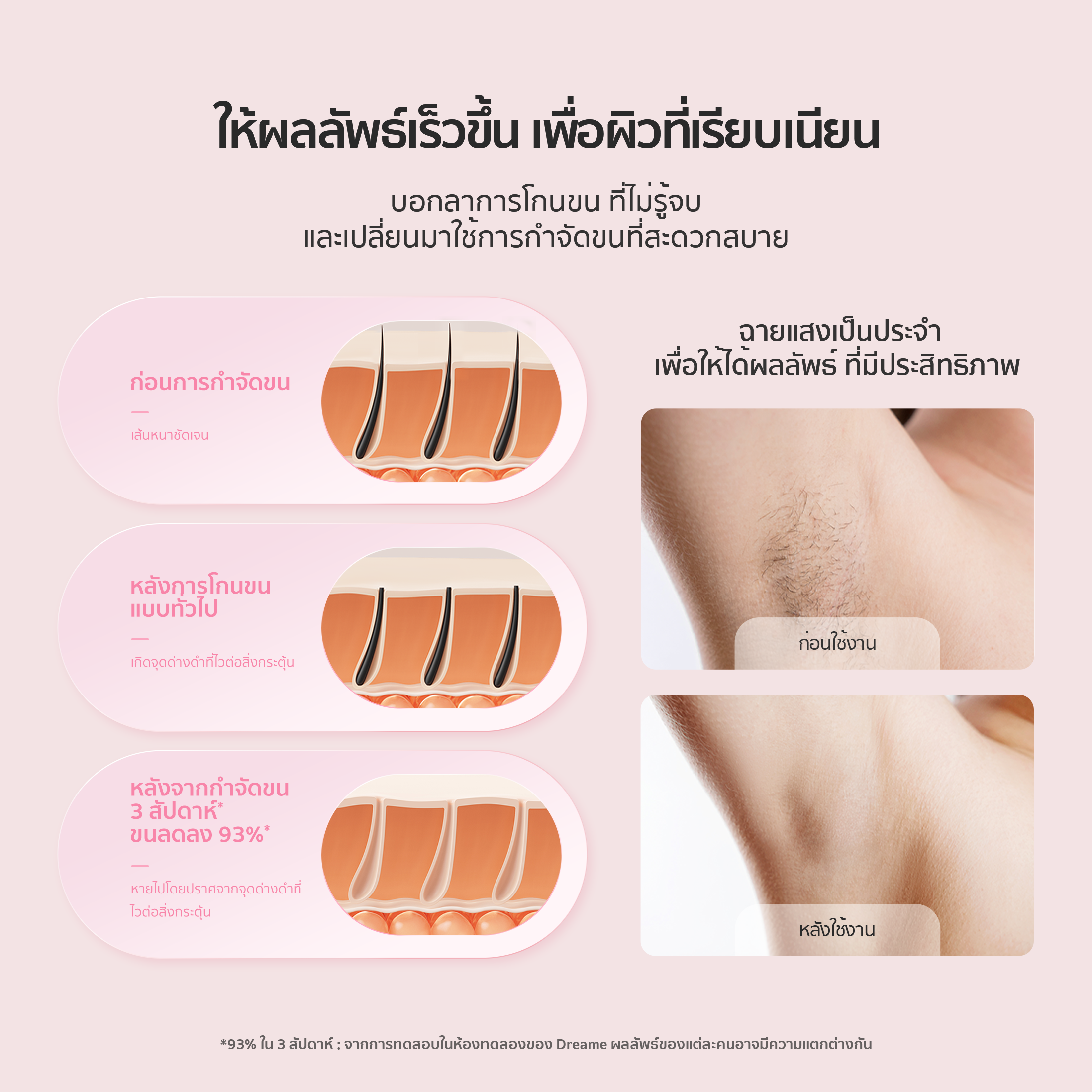 Dreame Sapphire IPL Hair Removal 21J เครื่องเลเซอร์กำจัดขนแบบ IPL Ice-Cooling 8 ระดับ ปกป้องผิวจากความร้อน - Dreame Thailand