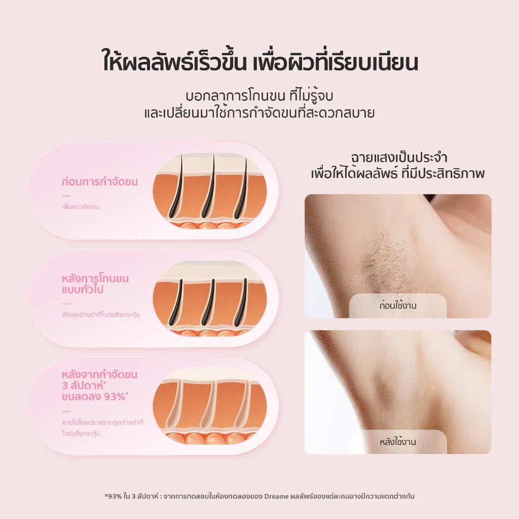 Dreame Sapphire IPL Hair Removal 21J  เครื่องเลเซอร์กำจัดขนแบบ IPL Ice-Cooling 8 ระดับ ปกป้องผิวจากความร้อน - Dreame Thailand