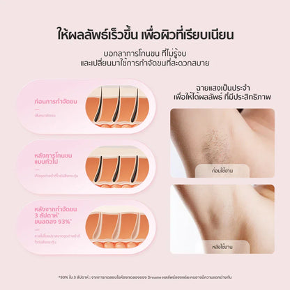 Dreame Sapphire IPL Hair Removal 21J  เครื่องเลเซอร์กำจัดขนแบบ IPL Ice-Cooling 8 ระดับ ปกป้องผิวจากความร้อน - Dreame Thailand